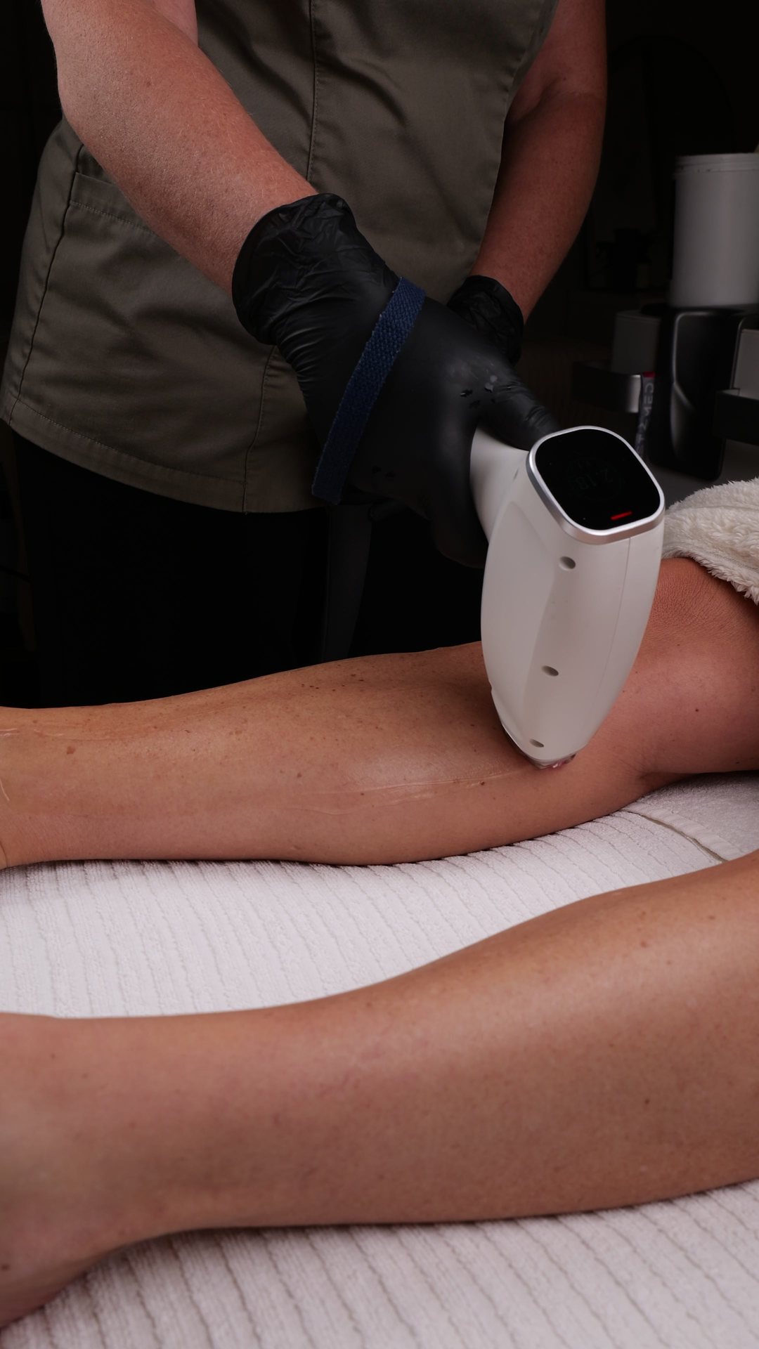 Hårborttagning med Aldix Smart Laser